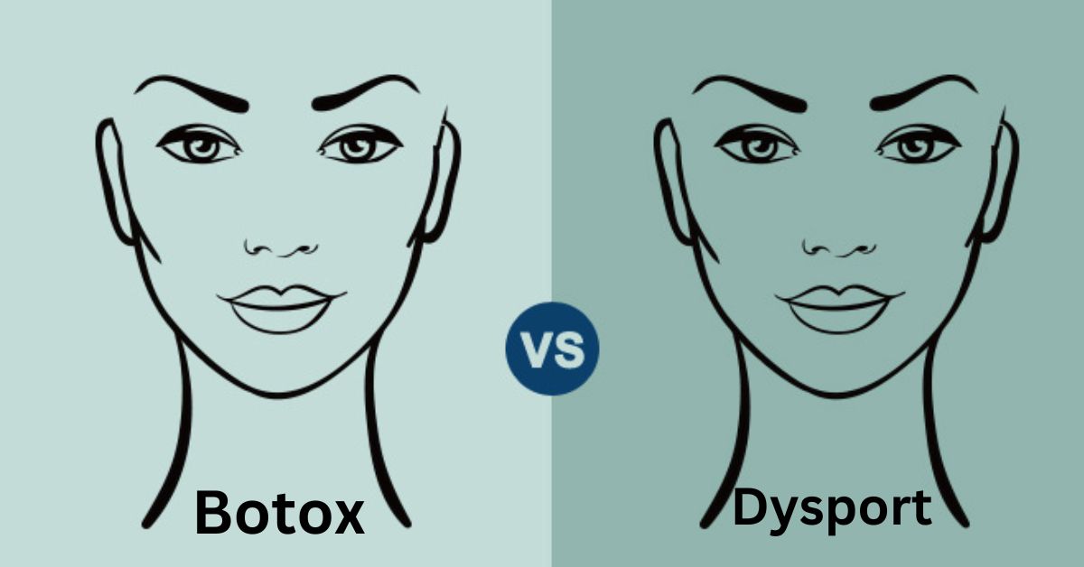 Dysport vs Botox
