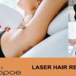 Laser Hair Removal