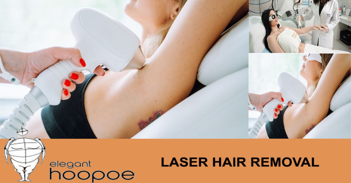 Laser Hair Removal