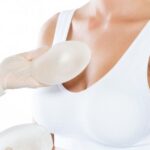 Breast Reduction