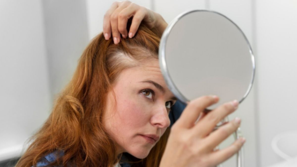 Hair Loss