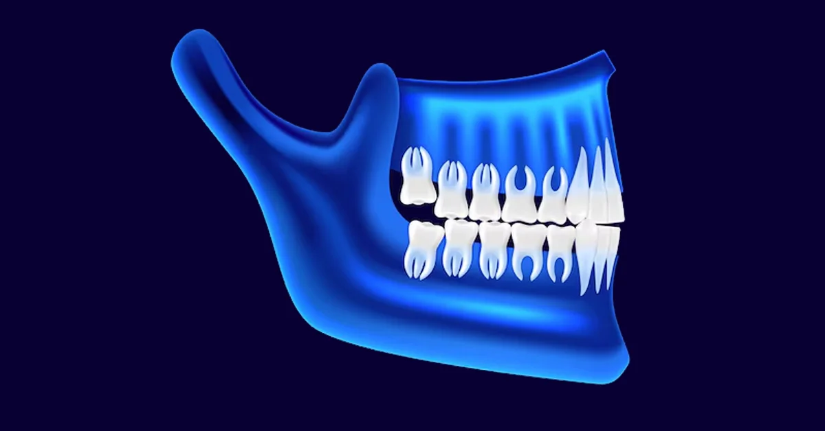 can wisdom teeth grow back