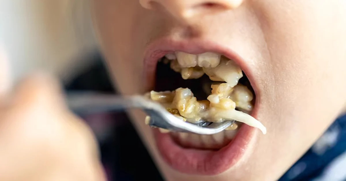 how long does it take to fill a cavity