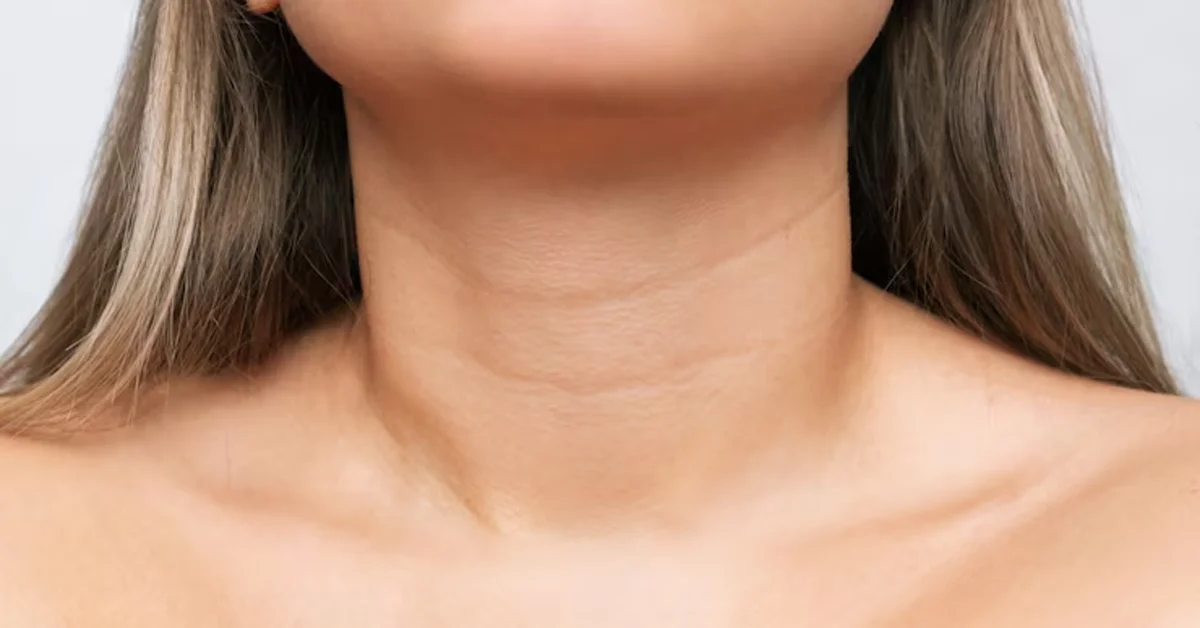 Neck Banding