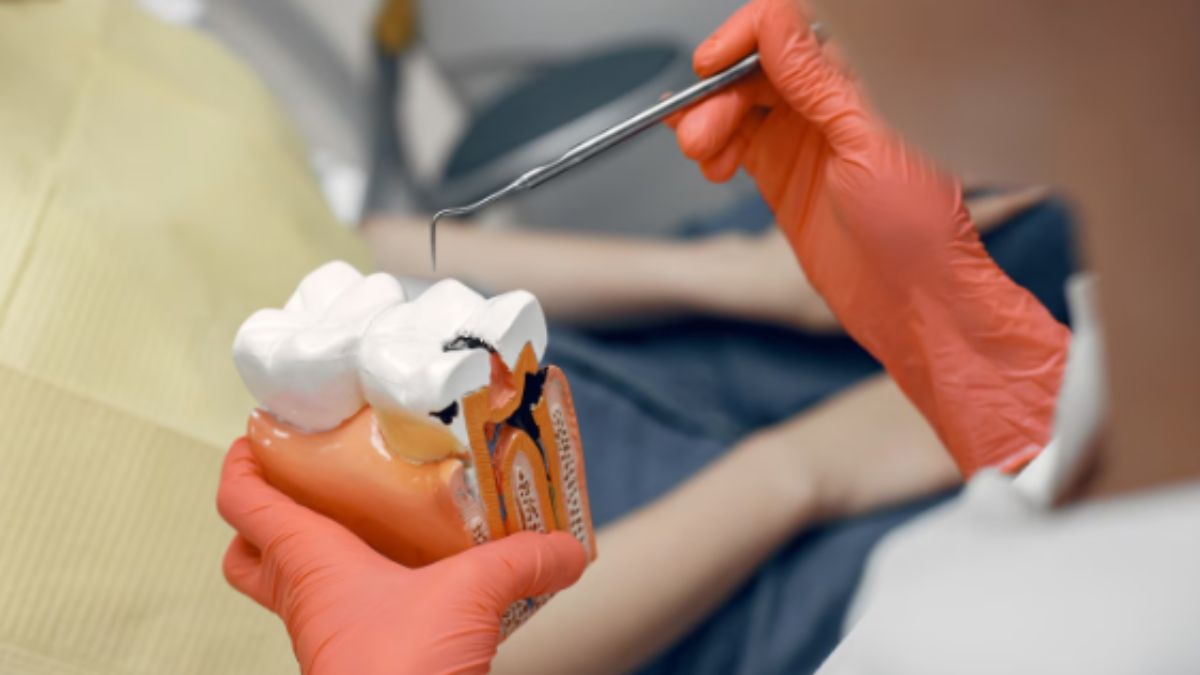 Root Canal Treatments