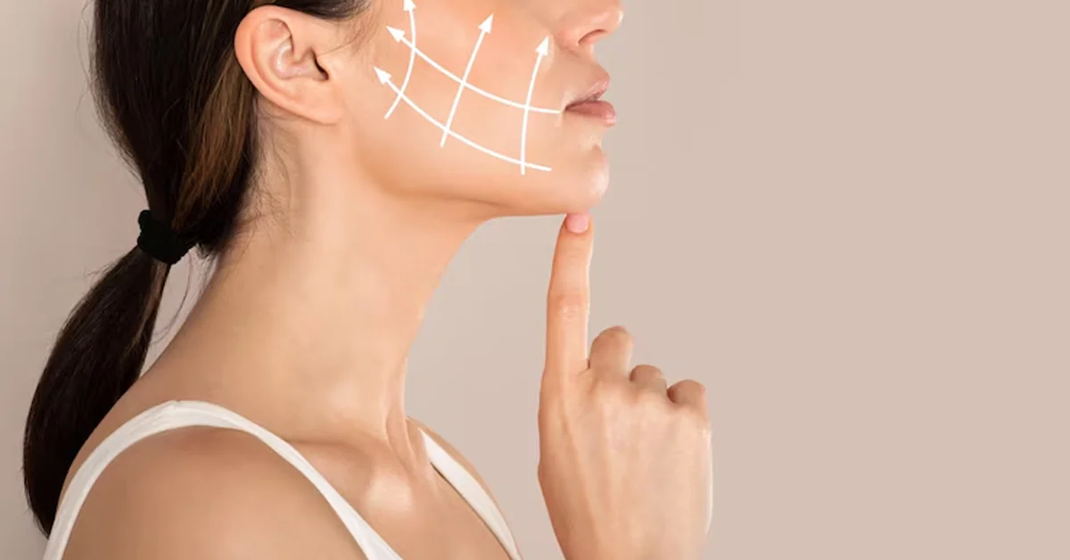 non surgical neck lift