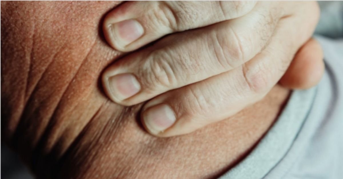 Personal Injury Claims