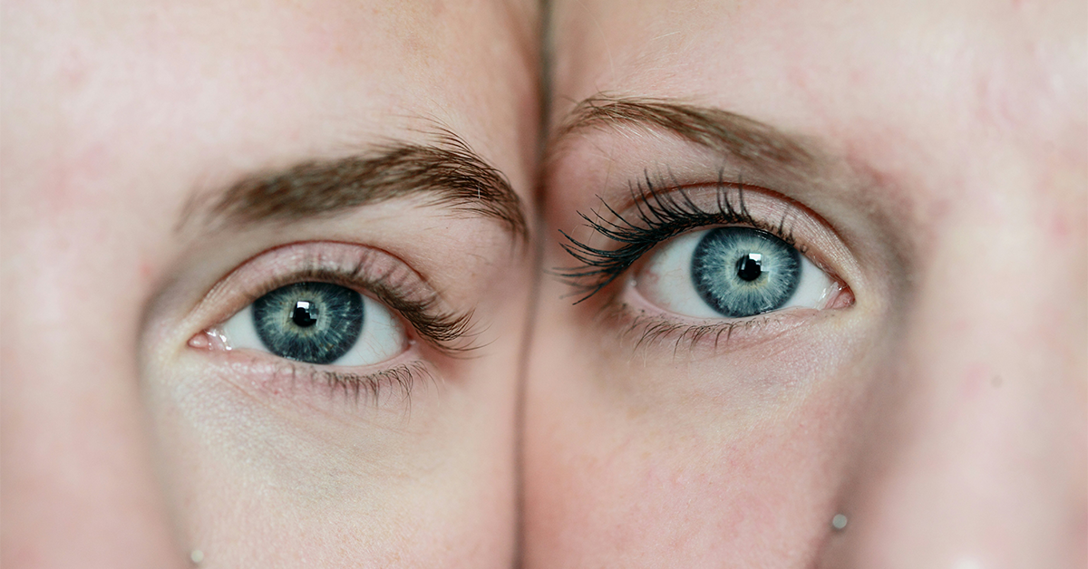can sunken eyes be reversed