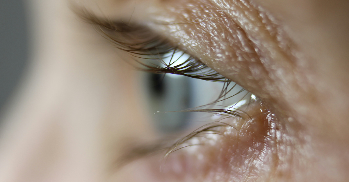 veins under eyes