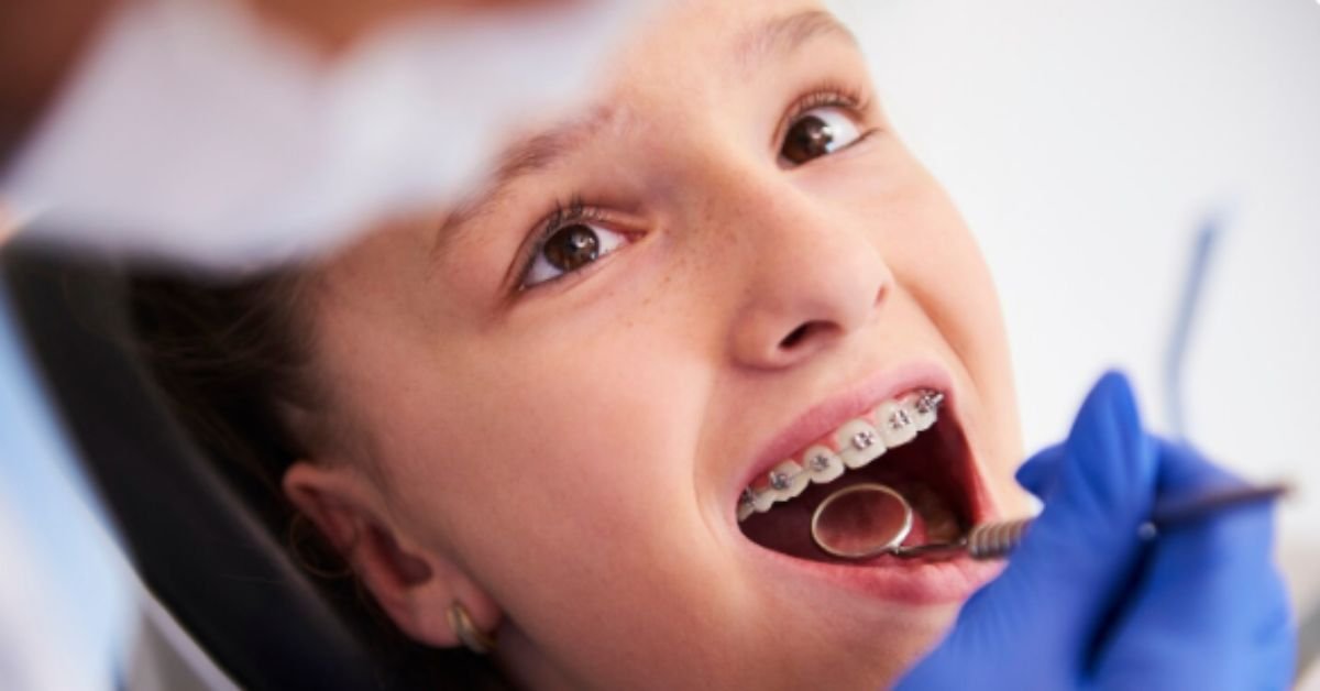 Orthodontic Treatment